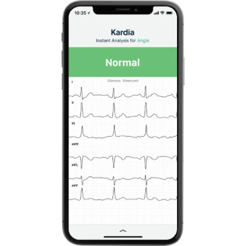 Omron Elettrocardiogramma KardiaMobile 6L KM-6L-E - Omron Elettrocardiogramma KardiaMobile 6L KM-6L-E